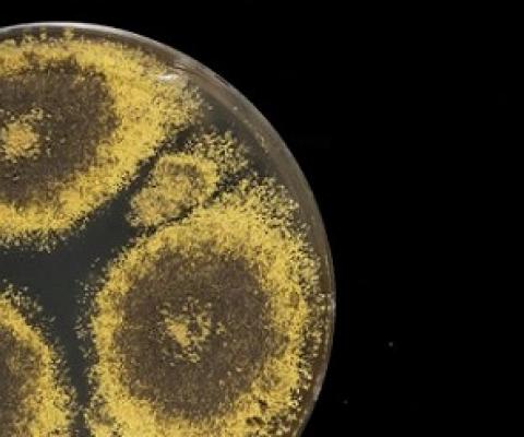 A culture of Eurotium herbariorum fungus, often retrieved from ocean-floor sediments.Credit: Tom Kleindinst/Woods Hole Oceanographic Institution (WHOI)