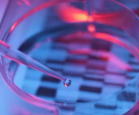 Even tiny water samples, like this droplet, often contain DNA of the fish and other species that live in an area. Using new eDNA sampling and analysis, scientists can help improve management of marine protected areas. Credit - Andrew Brookes Getty Images