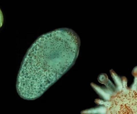 This photo shows a developing sea urchin, from egg (top left) to larva, to a metamorphosed (matured into adult form) individual. Dustin Marshall, Author provided